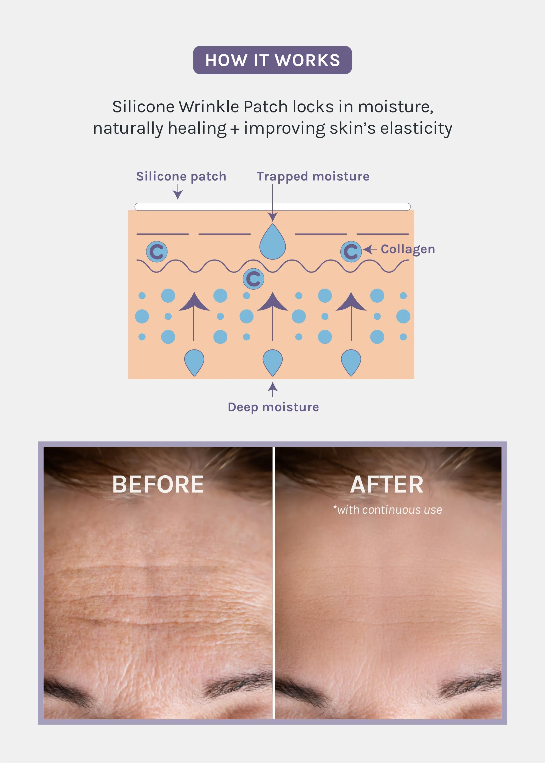AOA Skin Wrinkle Smoothing Patch  Chest